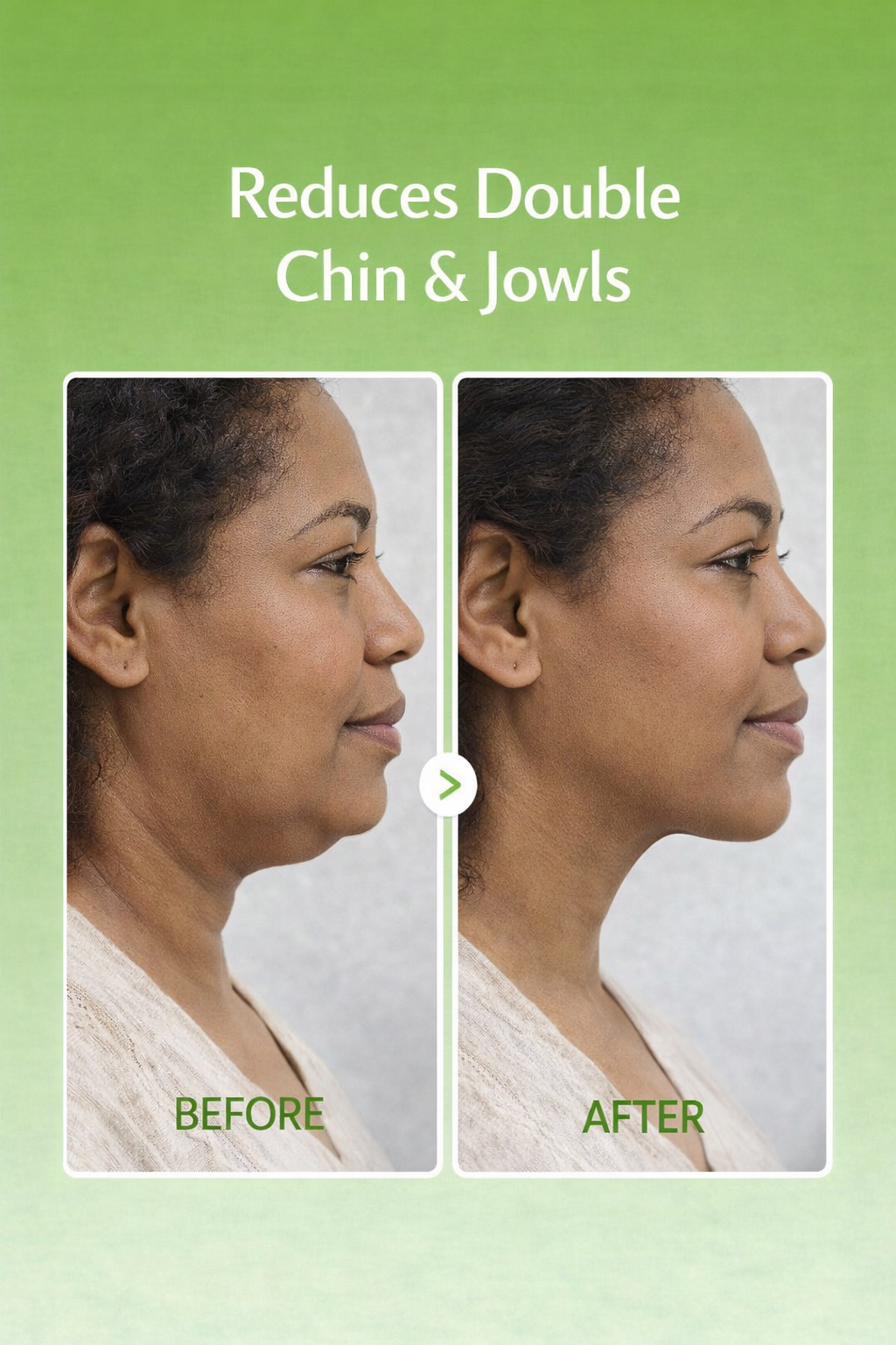 CactusLift™ Sculpting Hydrogel Mask